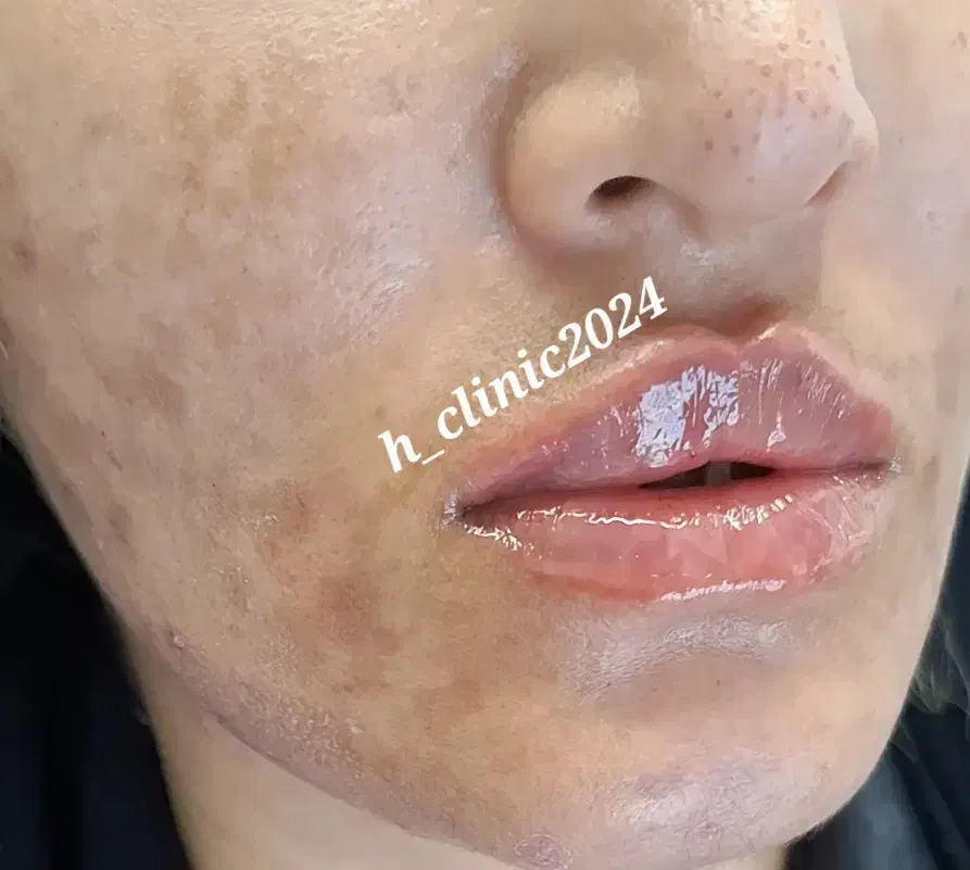 خدمات زیبایی پوست و مو با تخفیف ویژه|خدمات آرایشگری و زیبایی|قم, صفائیه|دیوار