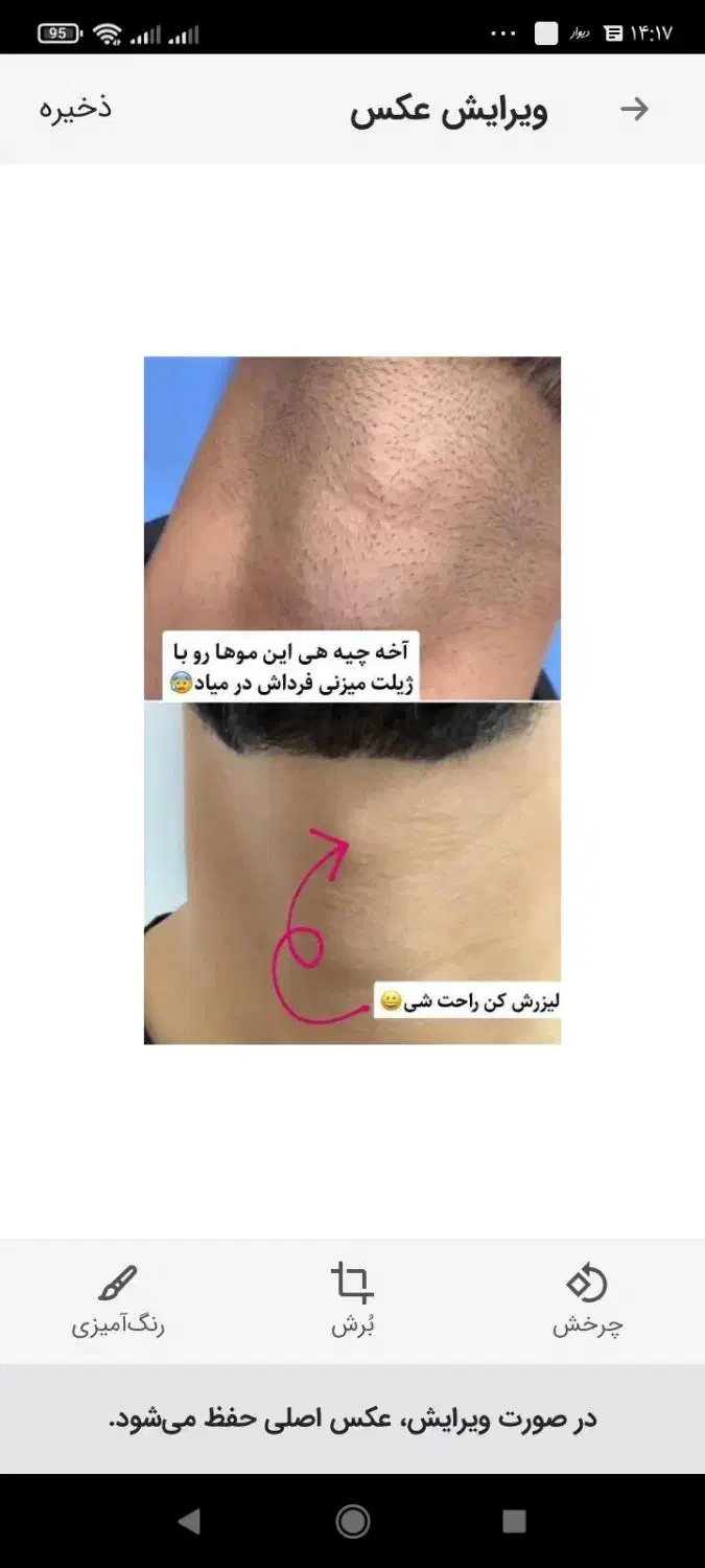 لیزر موهای زائد لیزر آقایان لیزر بانوان آموزش|خدمات آموزشی|اصفهان, بوستان آینه خانه|دیوار