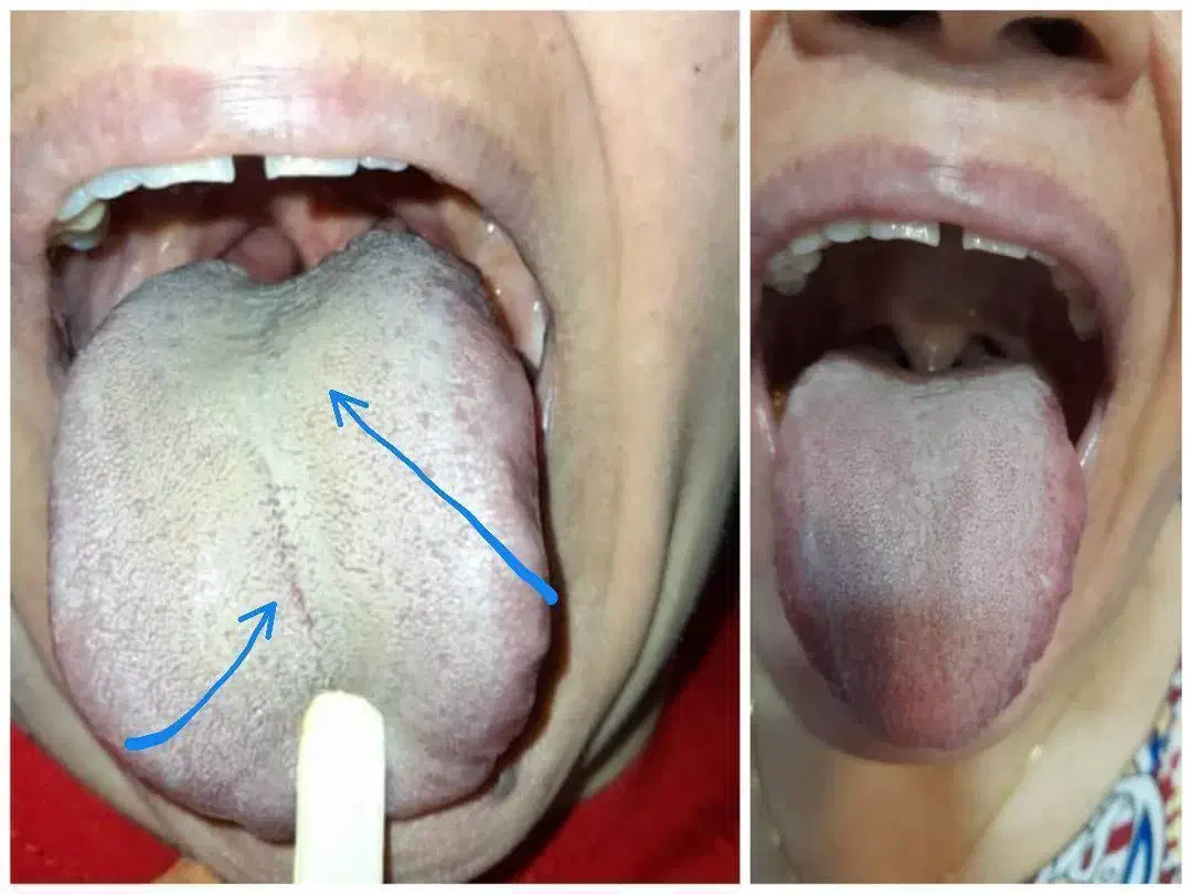 درمان قطعی کبدچرب|آرایشی، بهداشتی، درمانی|آمل, |دیوار