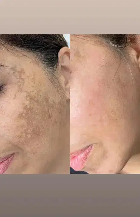 نمایندگی سرم 15 کاره مغذی لاکچری کوین منافذ ضدلک|حراج|مشهد, ایثار|دیوار