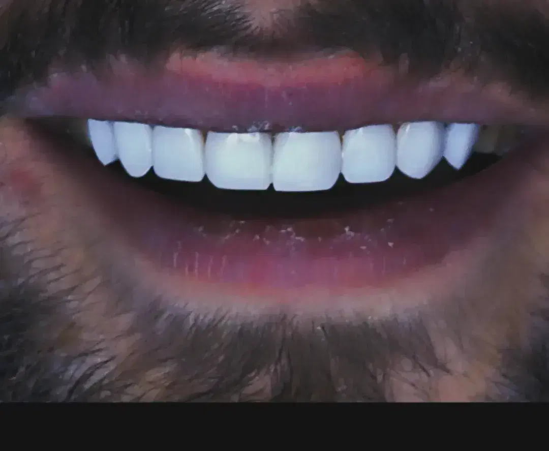 دندان پزشکی لبخند سفید|خدمات آرایشگری و زیبایی|ماهنشان, |دیوار