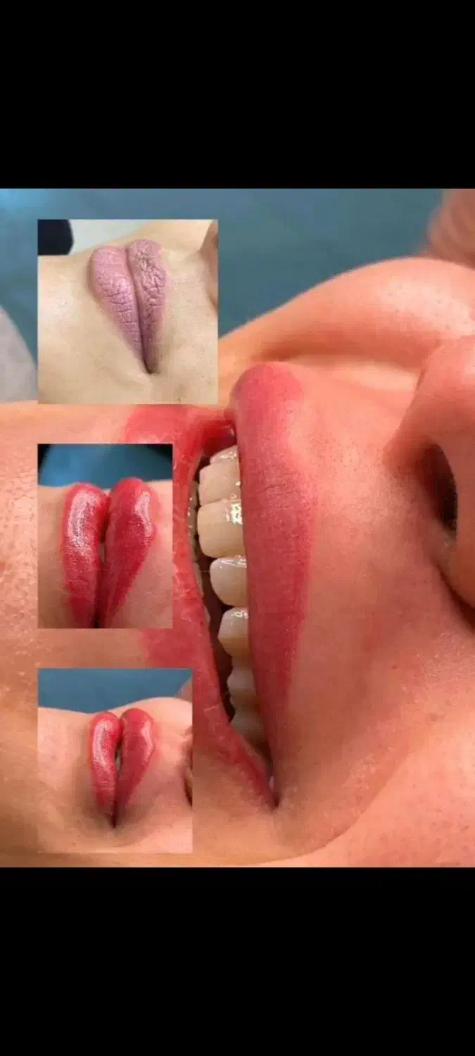 تخفیف یلدایی شیدینگ لب|خدمات آرایشگری و زیبایی|مشهد, شهید رضوی|دیوار