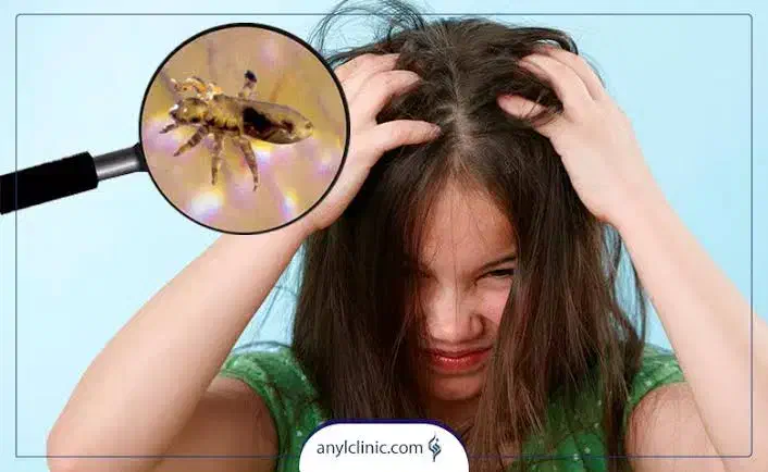 ا محلول ضد شپش|آرایشی، بهداشتی، درمانی|معصومیه, |دیوار