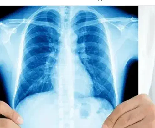 مشاوره طب سنتی برای مشکلات تنفسی|خدمات آرایشگری و زیبایی|رفسنجان, |دیوار