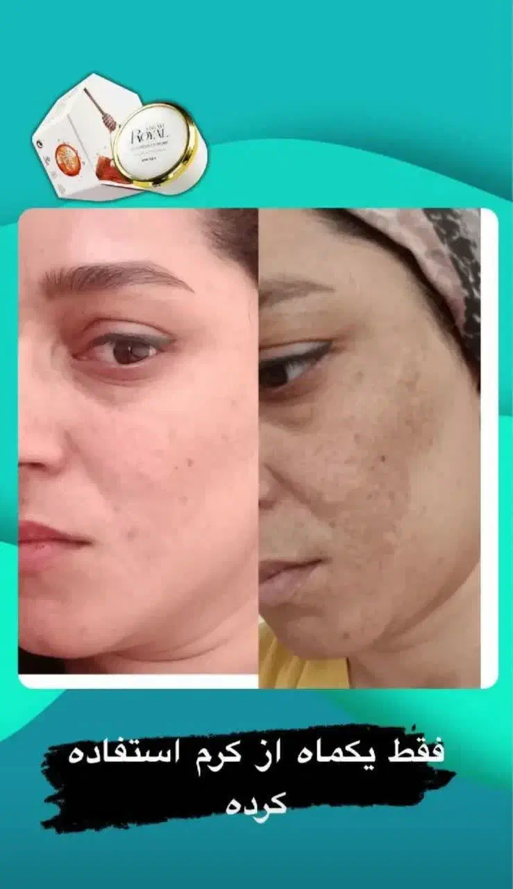 نمایندگی رویال دریاسوج ببرراضی نبودی پس میگیریم|آرایشی، بهداشتی، درمانی|دوگنبدان, |دیوار