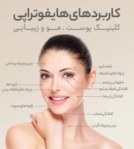 هایفو جوانساز لیفت|خدمات آرایشگری و زیبایی|مشهد, شریف|دیوار