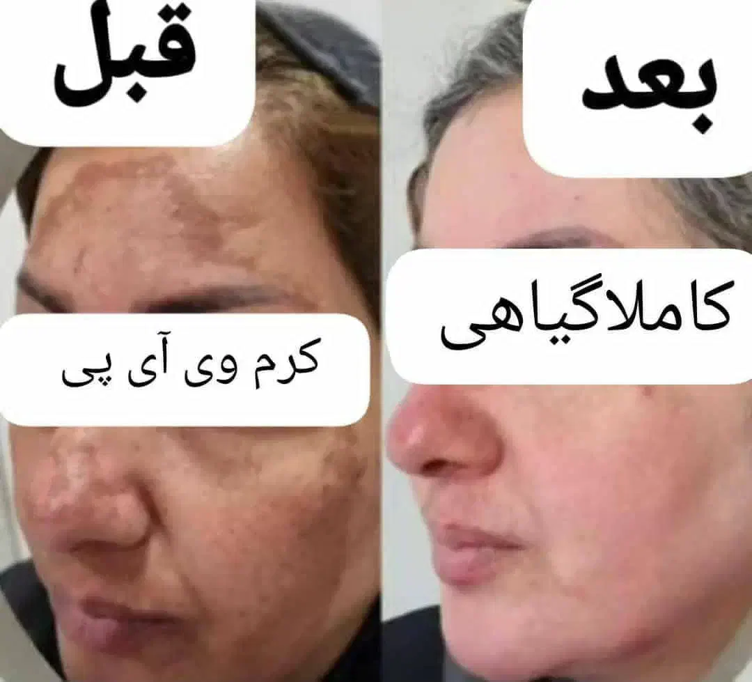 زیبایی خودتان رابه رخ بکشید|آرایشی، بهداشتی، درمانی|کازرون, |دیوار