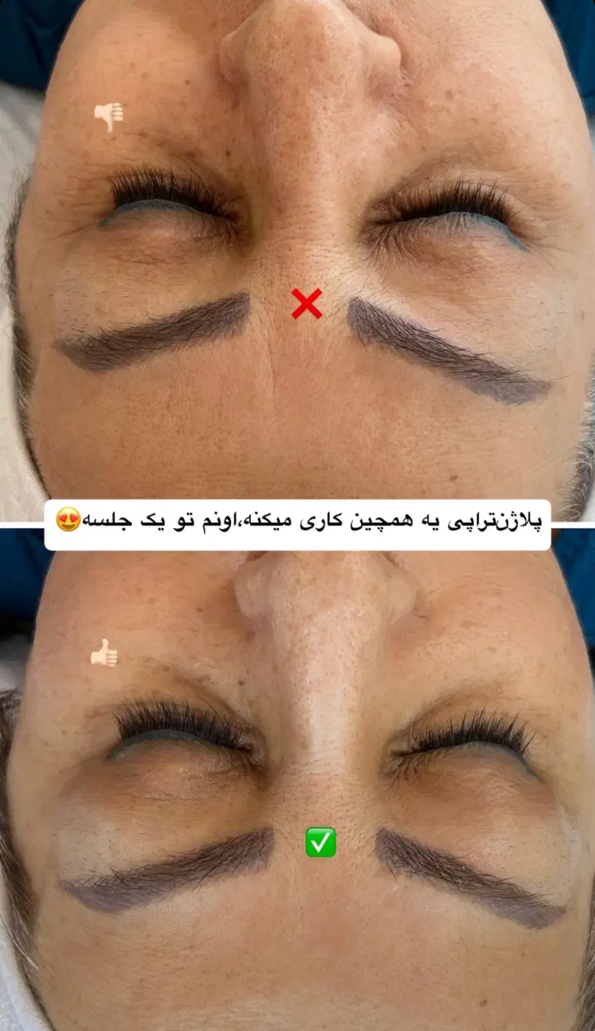 پاکسازی+ درما رایگان (۱۷۵ تومان )در کلینیک پزشک|خدمات آرایشگری و زیبایی|بیرجند, |دیوار