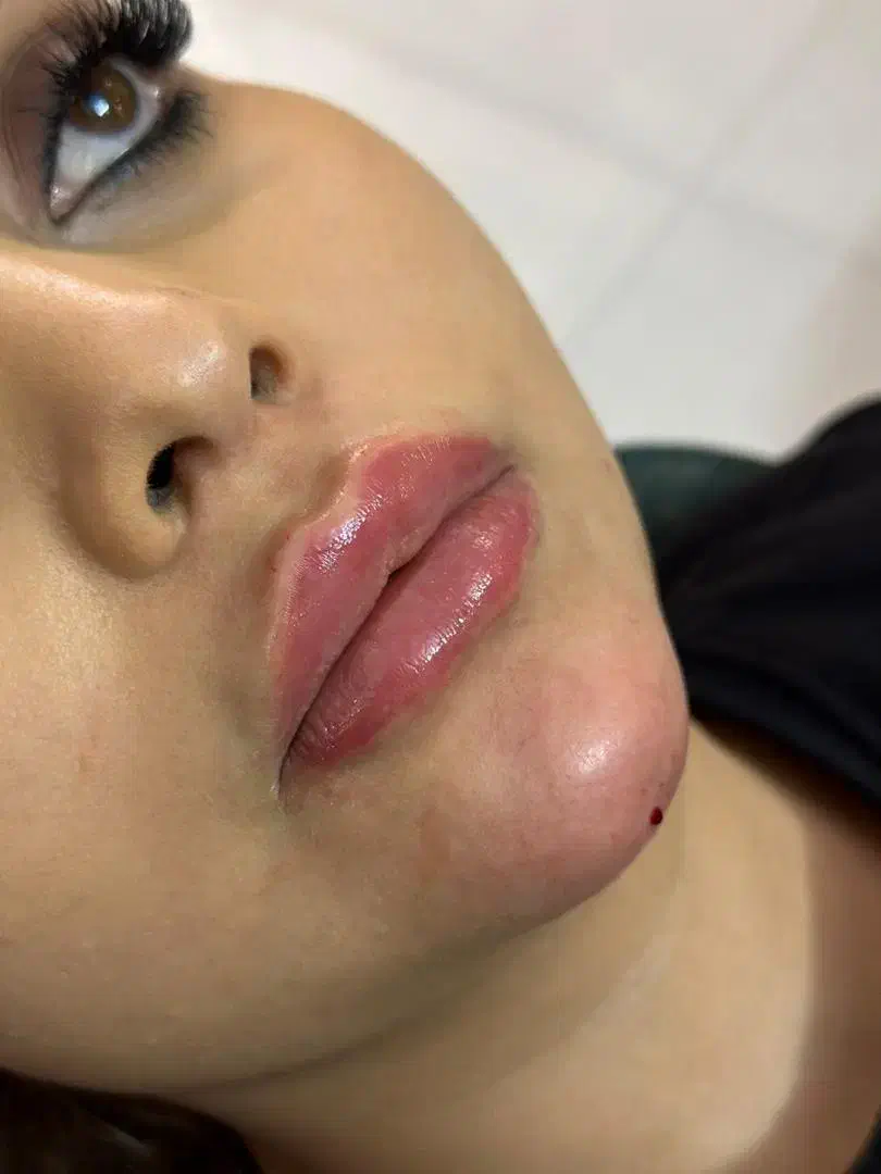 خدمات ژل وبوتاکس و دیگر خدمات زیبایی|خدمات آرایشگری و زیبایی|مشهد, ایثار|دیوار