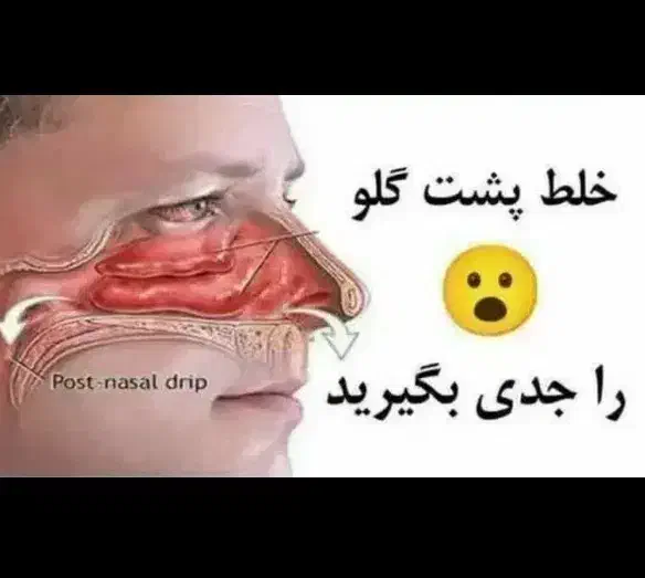 دمنوش گلو|آرایشی، بهداشتی، درمانی|زنجان, |دیوار