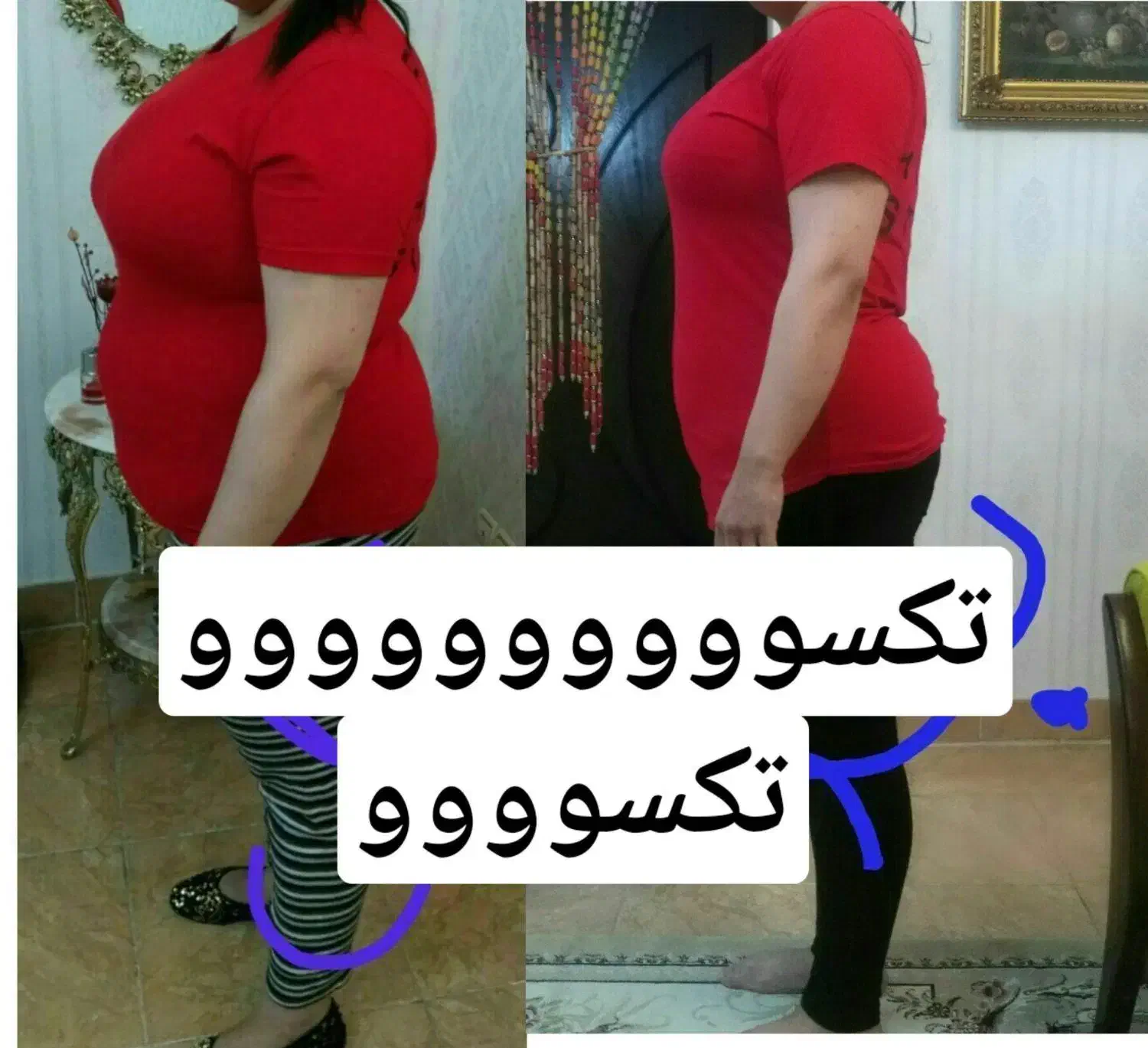 چربی سوزی مثل کره|آرایشی، بهداشتی، درمانی|زابل, |دیوار