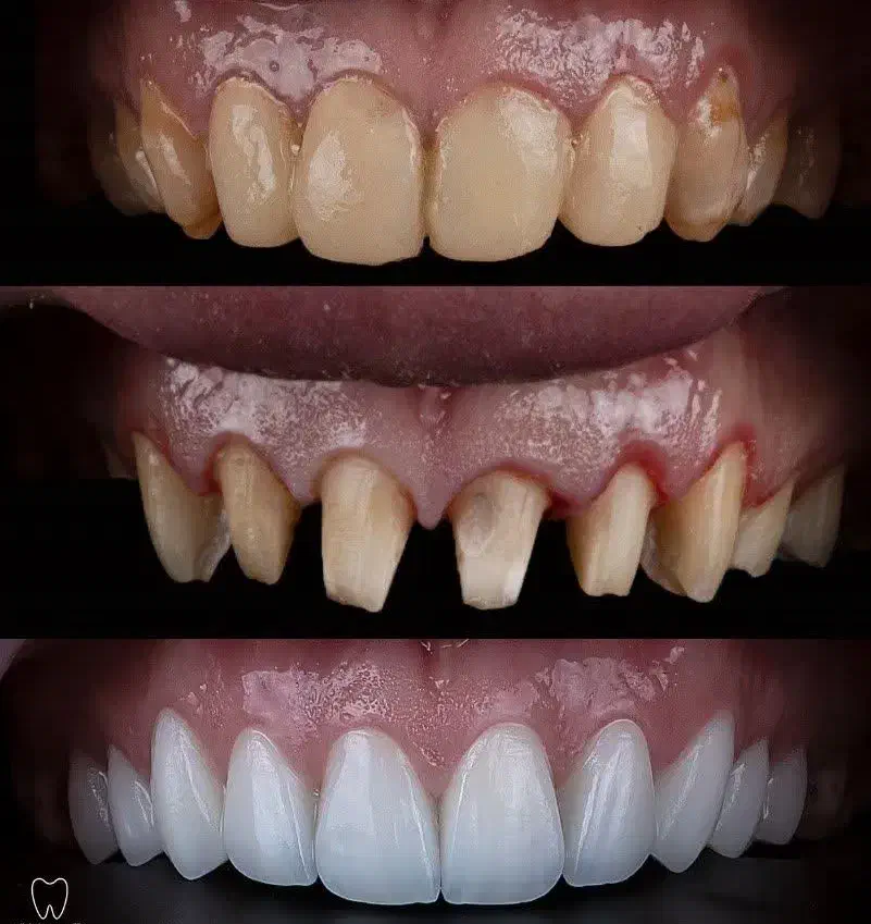 دندانپزشکی صدف (با شرایط اقساط) کامپوزیت|خدمات آرایشگری و زیبایی|قم, حقیقت|دیوار