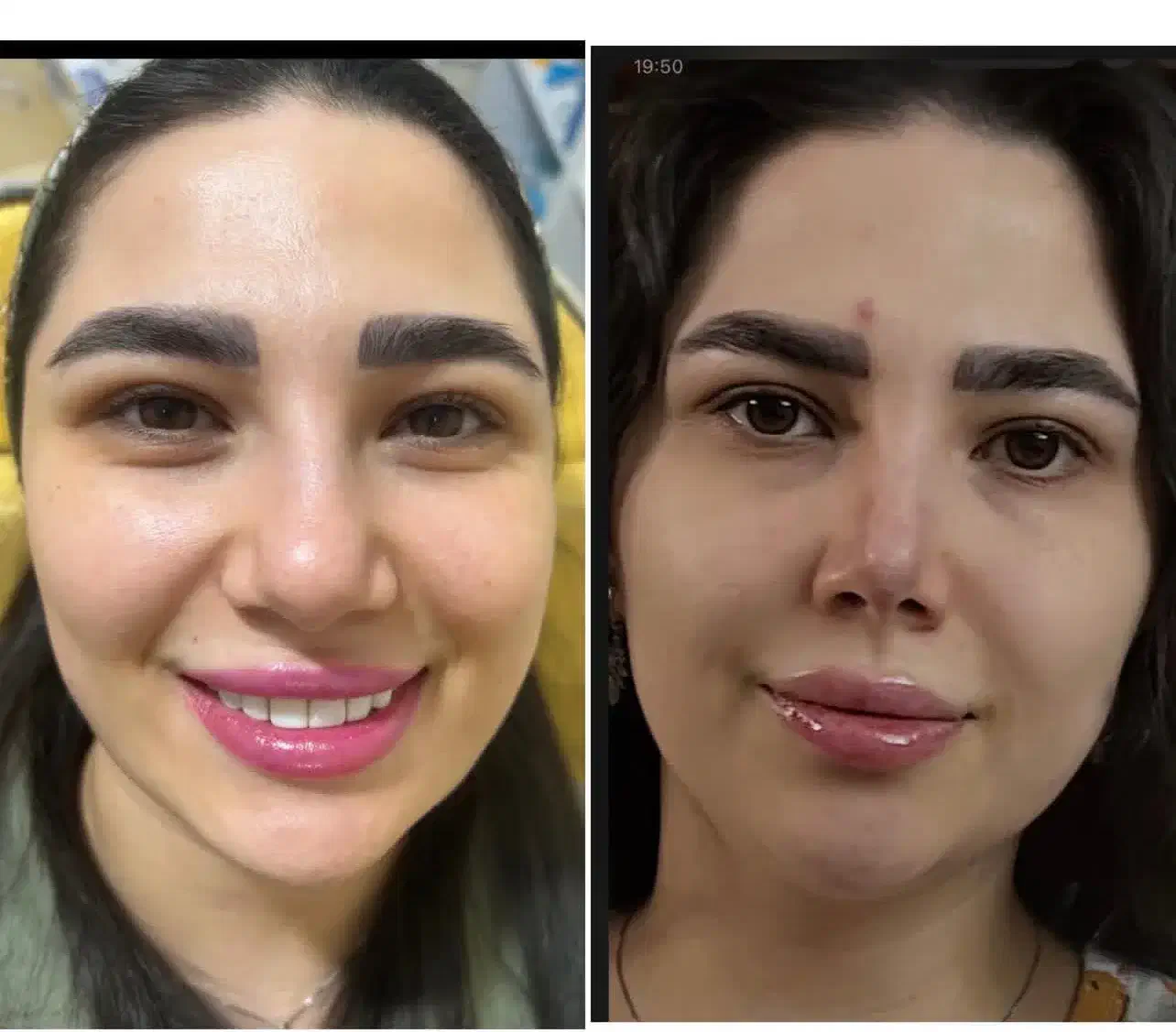 کوچک شدن بینی تضمینی فقط با ۵ میلیون|خدمات آرایشگری و زیبایی|تهران, هاشمی|دیوار