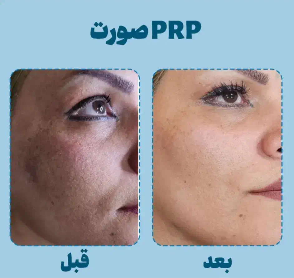 خدمات زیبایی|خدمات آرایشگری و زیبایی|دورود, |دیوار