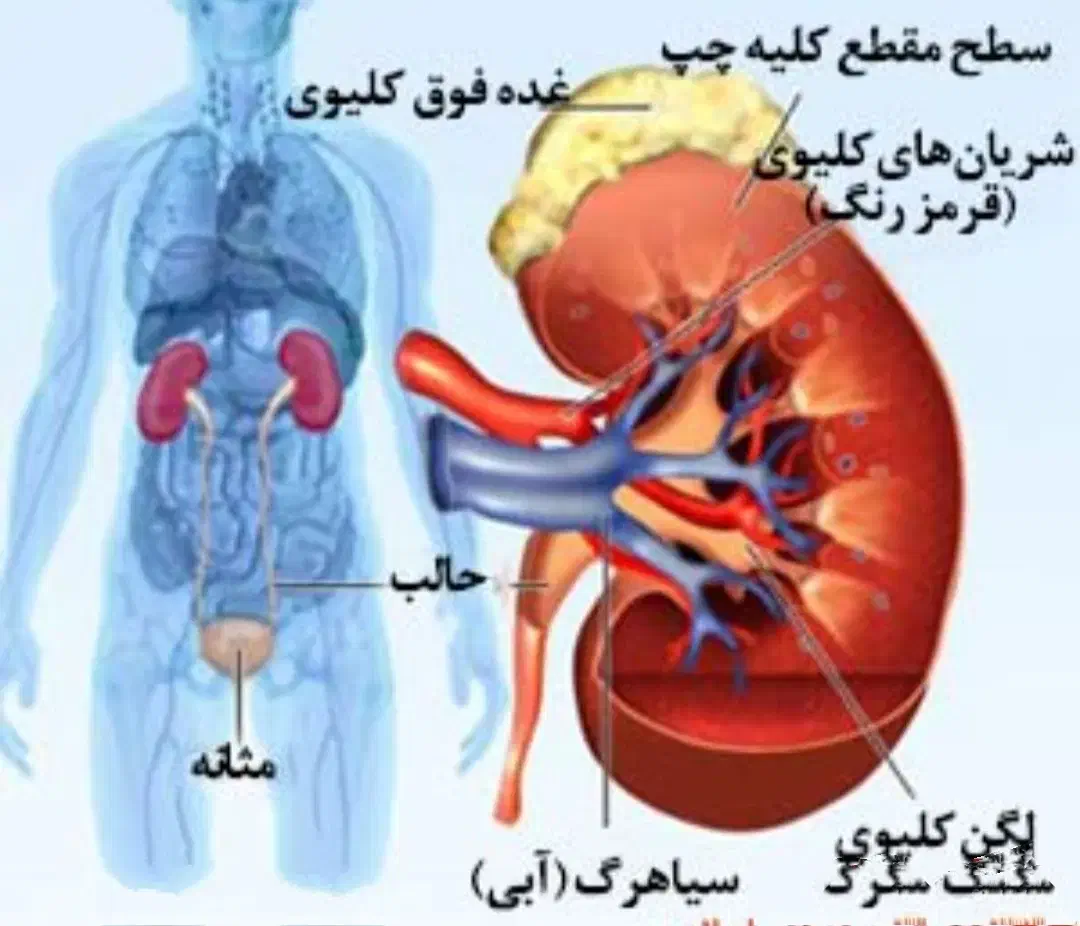 بهبود مشکلات کلیه|آرایشی، بهداشتی، درمانی|میاندوآب, |دیوار