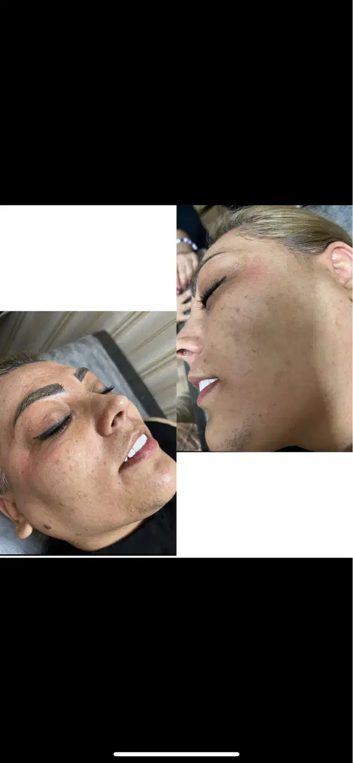 رفع لک و تیرگی صورت و بدن|آرایشی، بهداشتی، درمانی|پاکدشت, پاکدشت (مامازند)|دیوار