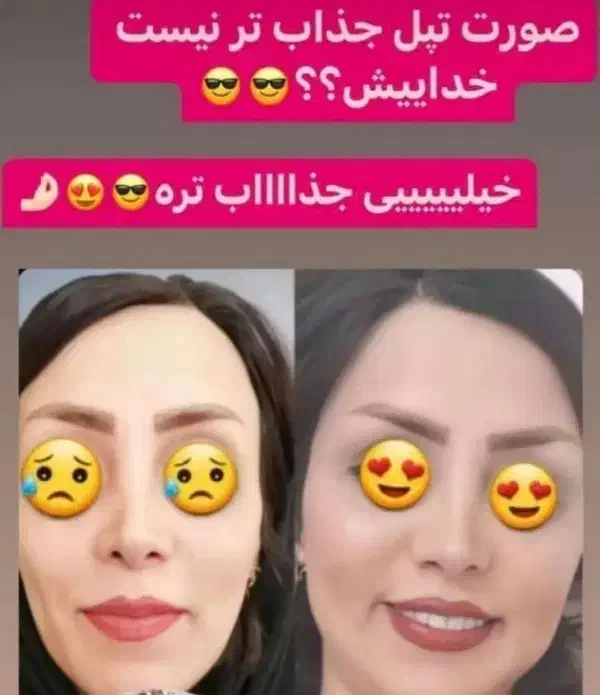 پک چاقی صورت * تضمینی*|آرایشی، بهداشتی، درمانی|قم, شهید رجایی|دیوار