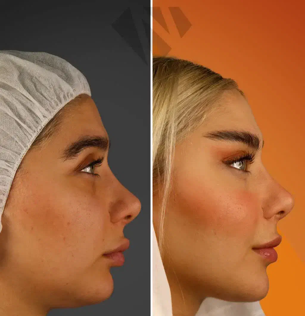 عمل بینی و جراحی لیپوساکشن با تیم پزشکان|خدمات آرایشگری و زیبایی|تهران, فلسطین (میدان انقلاب)|دیوار