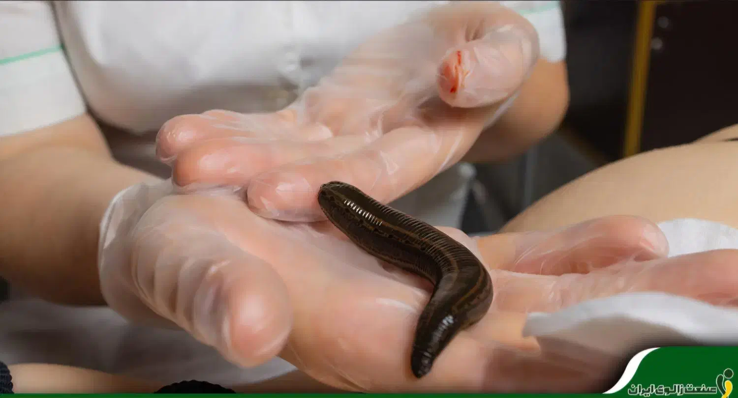 بادکش، حجامت ، زالو درمانی|خدمات آرایشگری و زیبایی|چناران, |دیوار