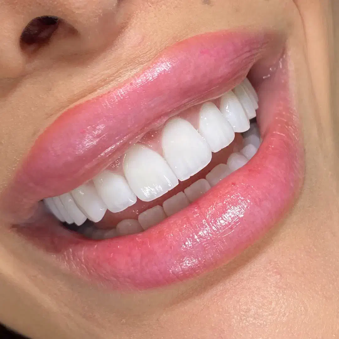 کامپوزیت|پزشکی|خرم‌آباد, |دیوار