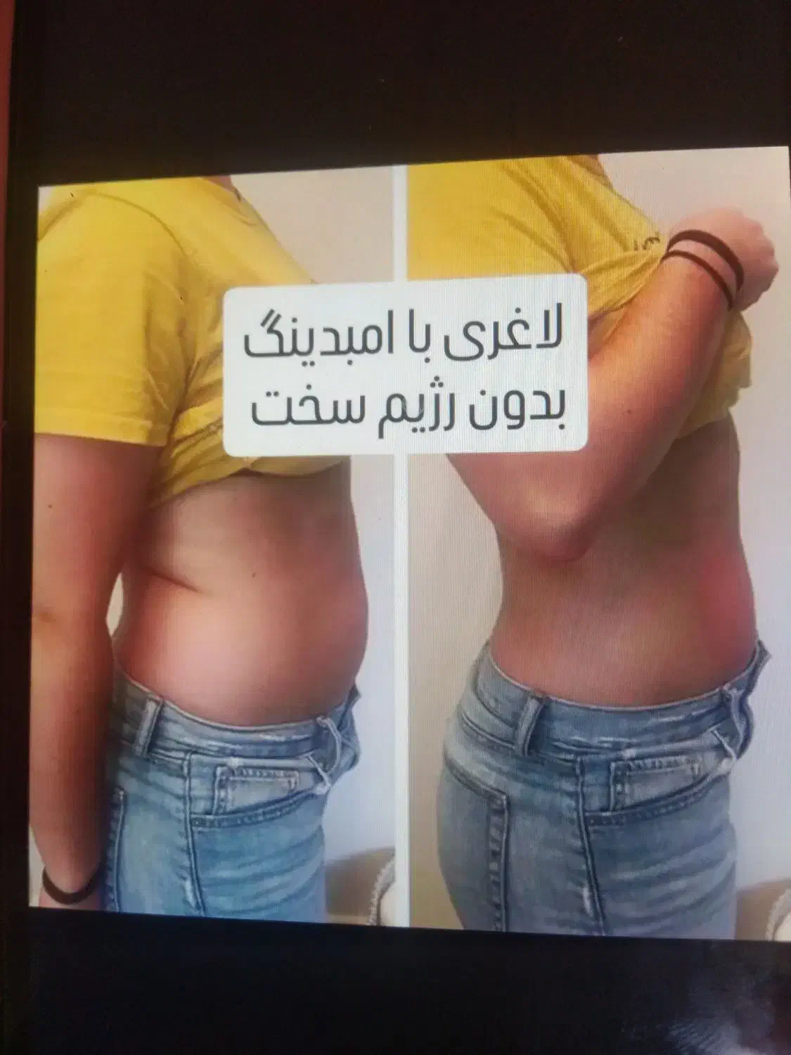 لاغری|آرایشی، بهداشتی، درمانی|شیراز, تندگویان|دیوار