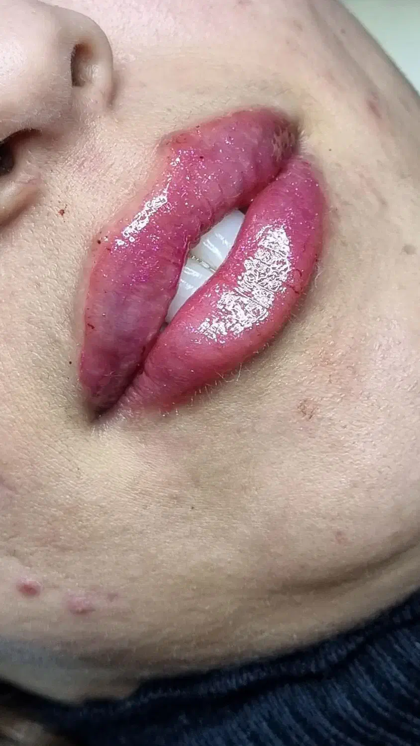 درخواست مدل برای تزریق لب|خدمات آرایشگری و زیبایی|کرمان, |دیوار