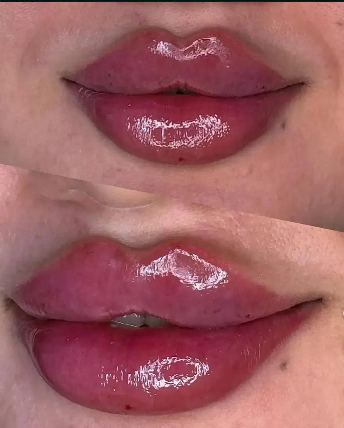 ژل،بوتاکس،پی آرپی،میکرونیدلینگ|خدمات آرایشگری و زیبایی|اصفهان, خانه اصفهان|دیوار