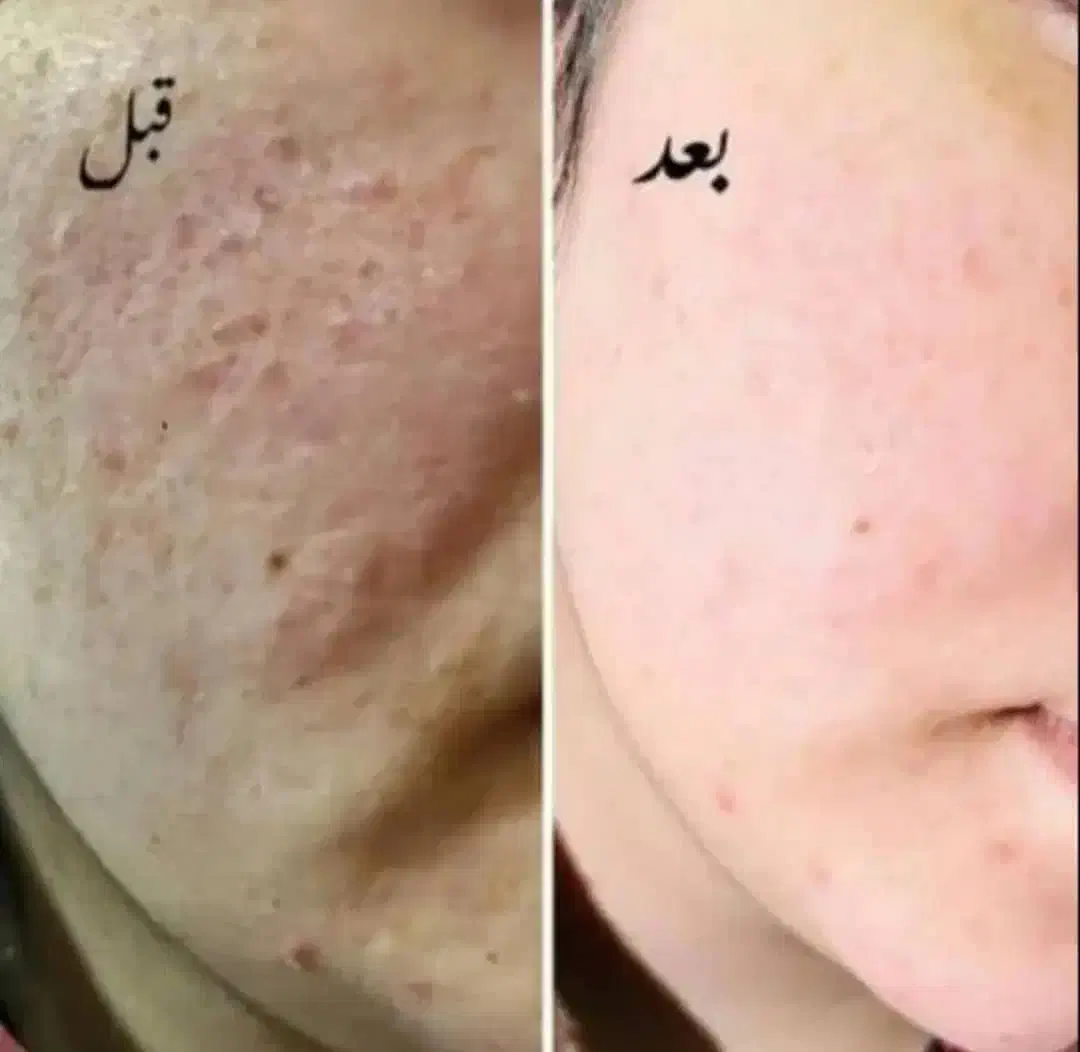 روشن کننده ۳۹۹|آرایشی، بهداشتی، درمانی|جیرفت, |دیوار