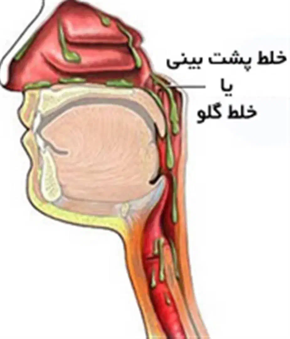 وداع با خلط با قدرت طبیعت|خوردنی و آشامیدنی|ری, علایین|دیوار