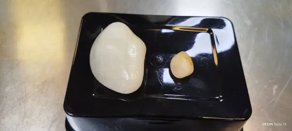 سنگ|جواهرات|تهران, نیاوران|دیوار