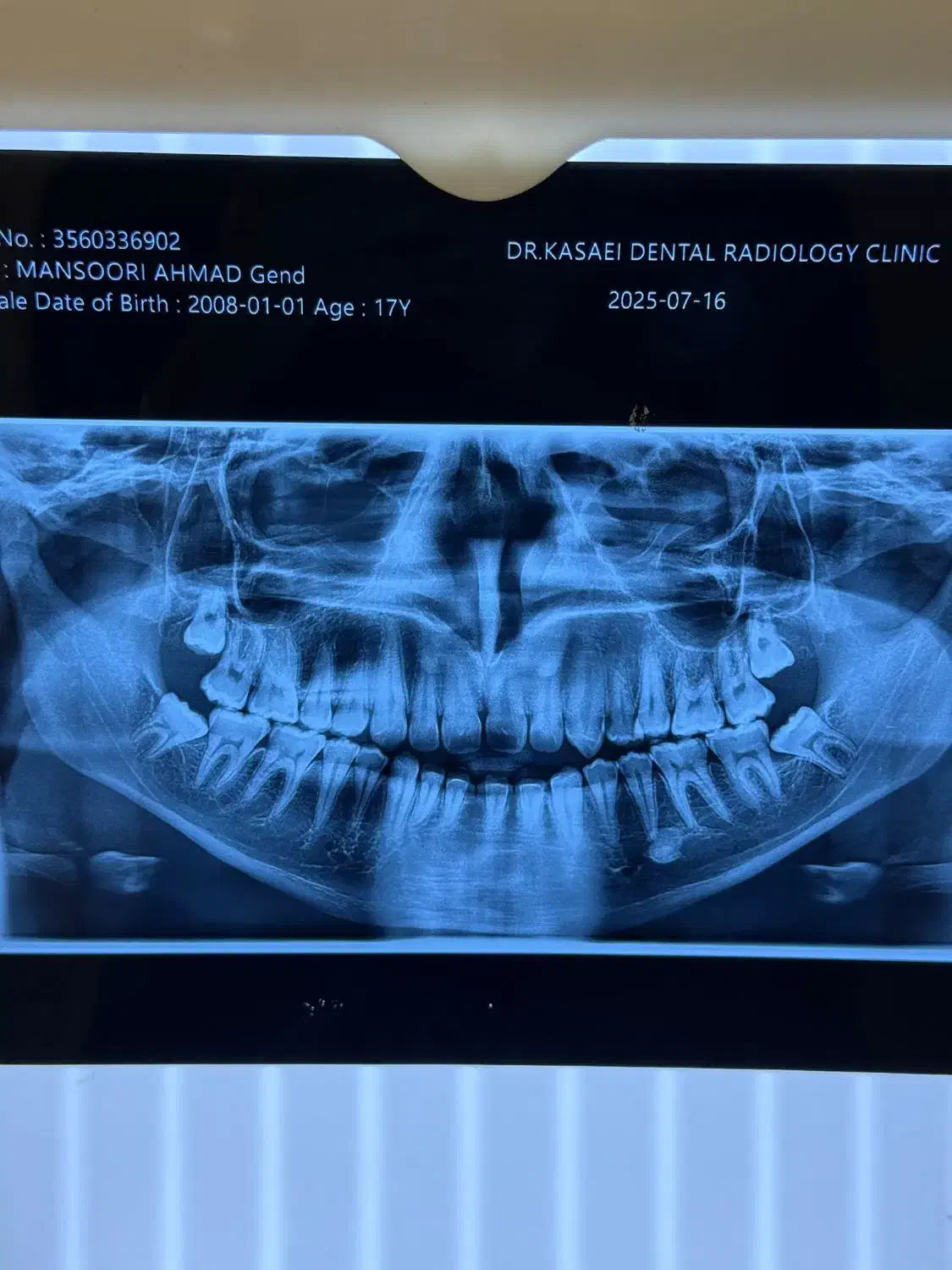 استخدام دستیار دندانپزشک|استخدام درمانی، زیبایی، بهداشتی|بندر کنگان, |دیوار
