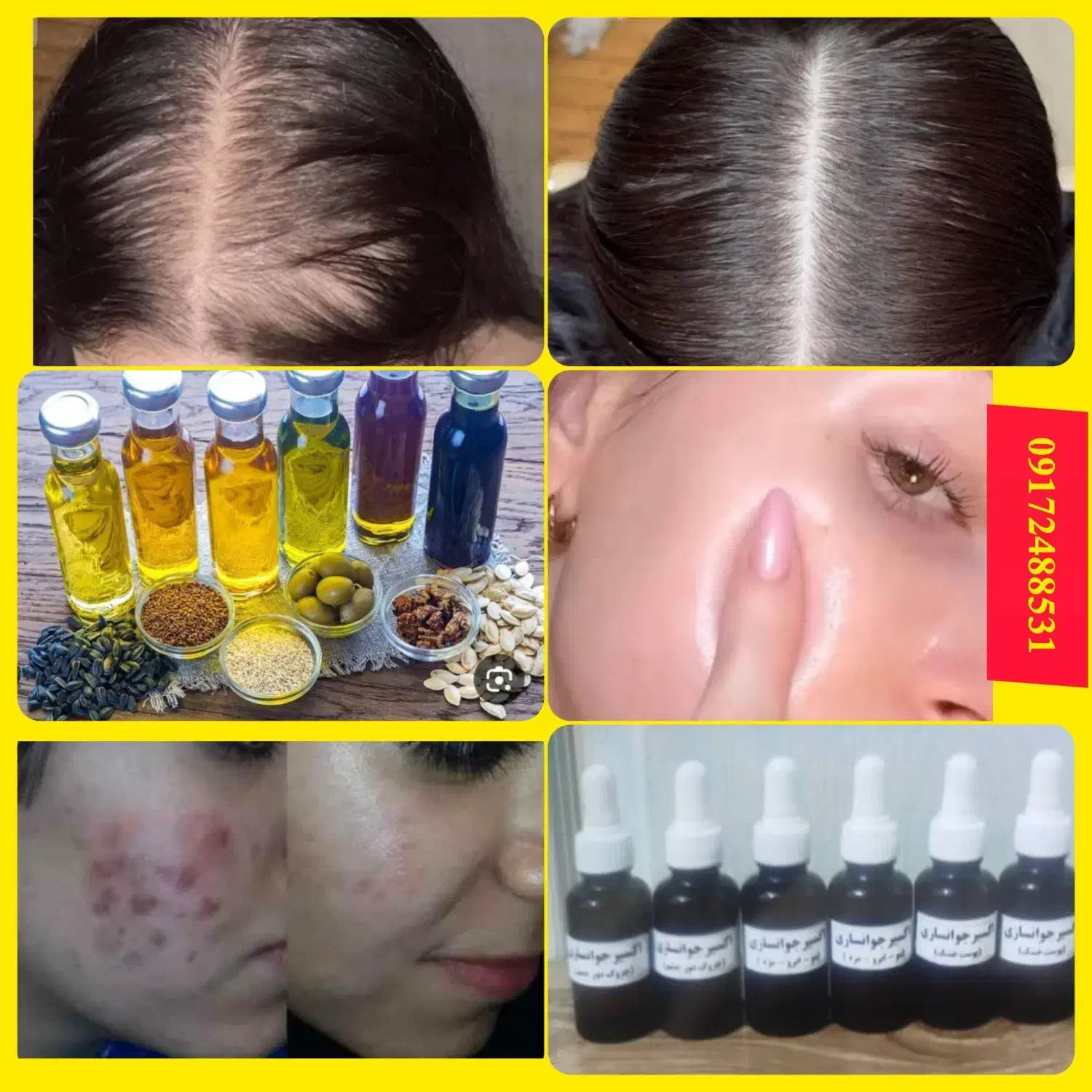 آموزش تخصصی روغن تراپی|خدمات آموزشی|تهران, یوسفآباد|دیوار