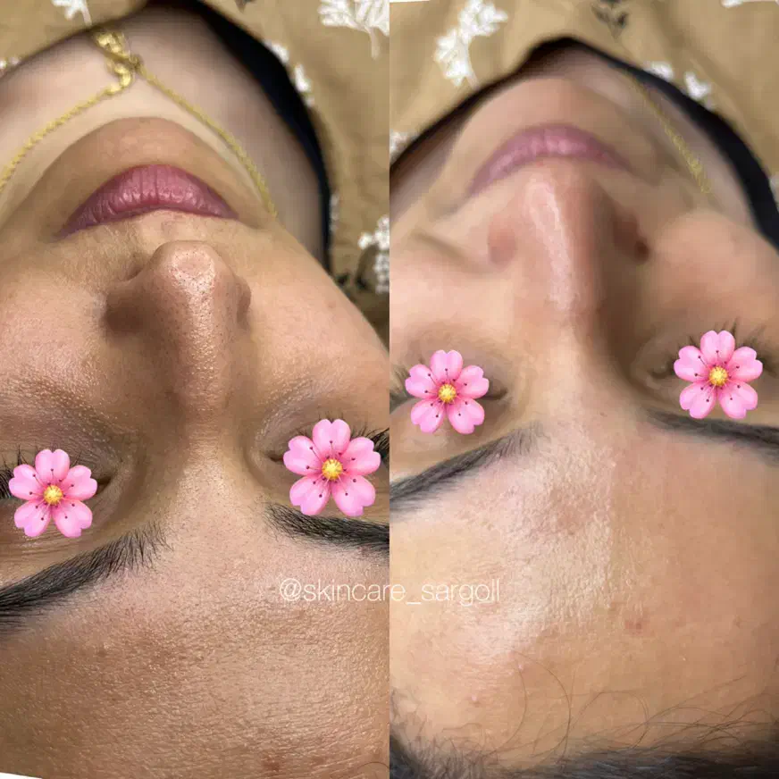 پاکسازی و فیشال|خدمات آرایشگری و زیبایی|شیراز, معالی‌آباد|دیوار