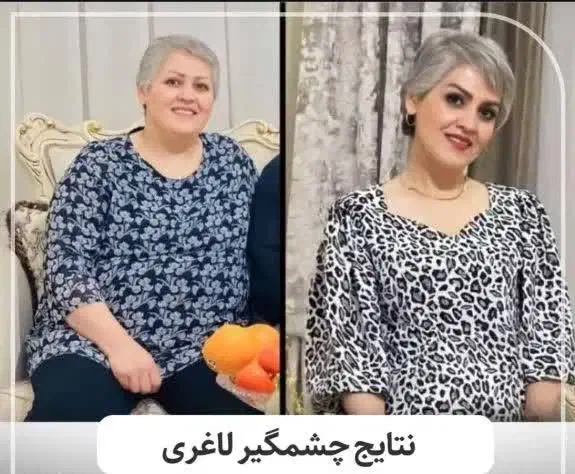 جشنوار لاغری در1جلسه ۳ تا ۵ سانت کاهش سایز تضمینی|خدمات آرایشگری و زیبایی|اصفهان, ناژوان|دیوار