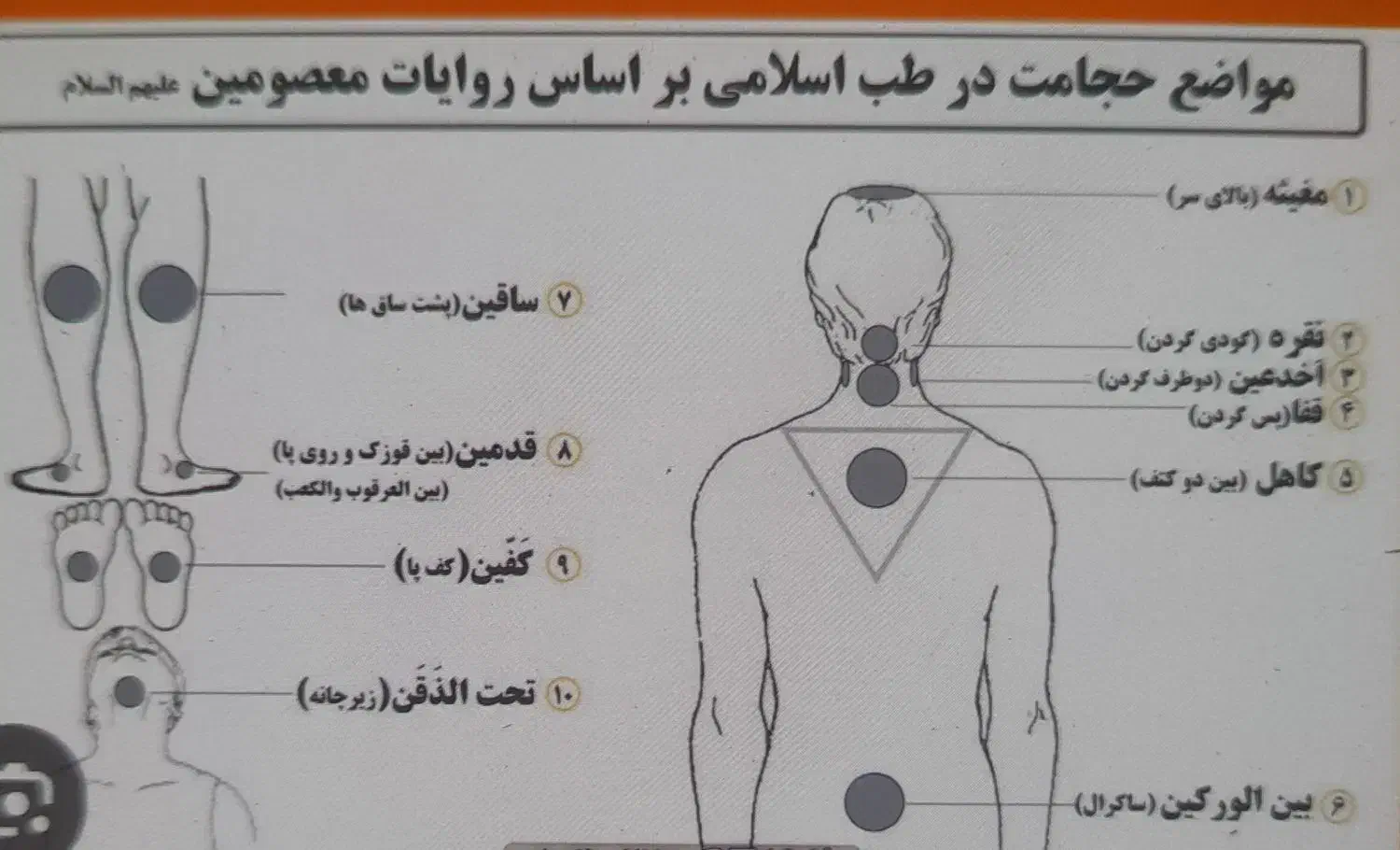 حجامت فصد طب سوزنی کایروپراکتیک بادکش رگ گیری|خدمات آرایشگری و زیبایی|نسیم‌شهر, |دیوار