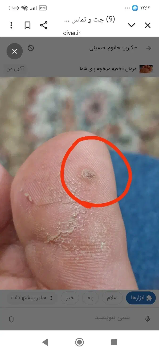 درمان|آرایشی، بهداشتی، درمانی|مشهد, کارمندان دوم|دیوار