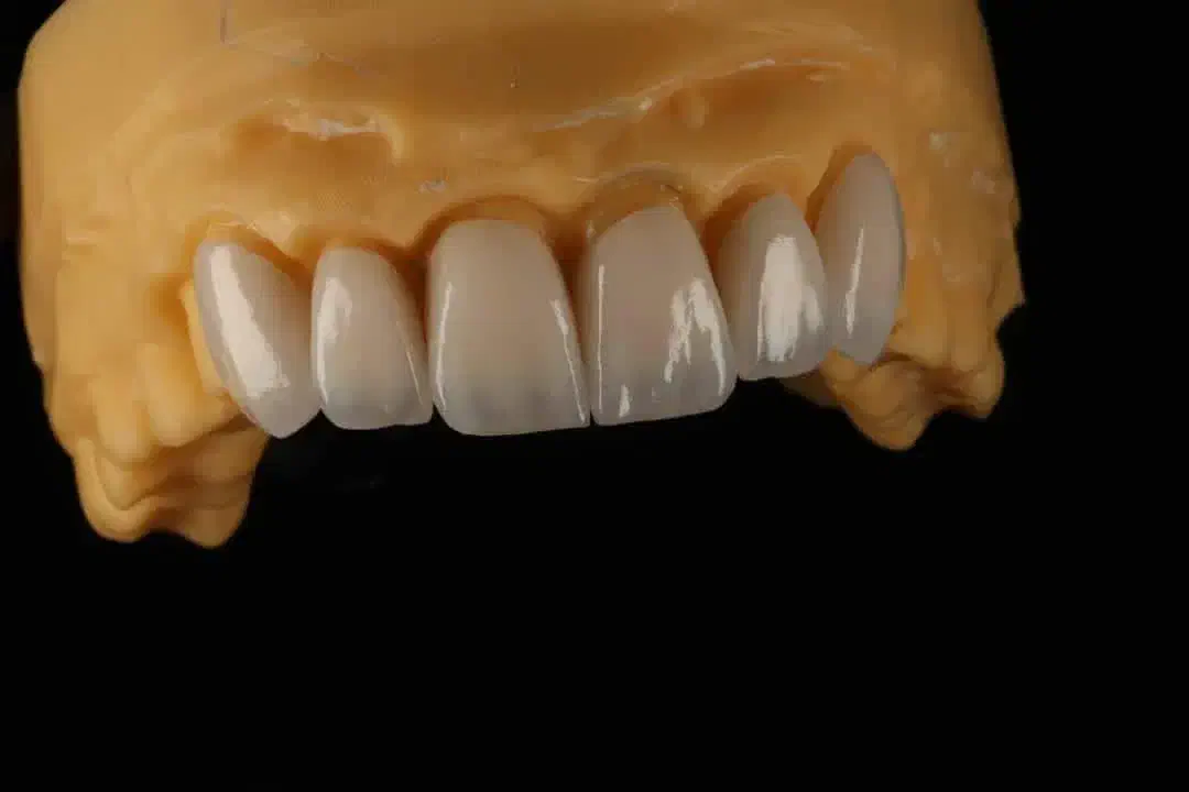 به یک نفر خانم  در لابراتوار دندانسازی نیازمندیم|استخدام درمانی، زیبایی، بهداشتی|مهاباد (آذربایجان غربی), |دیوار