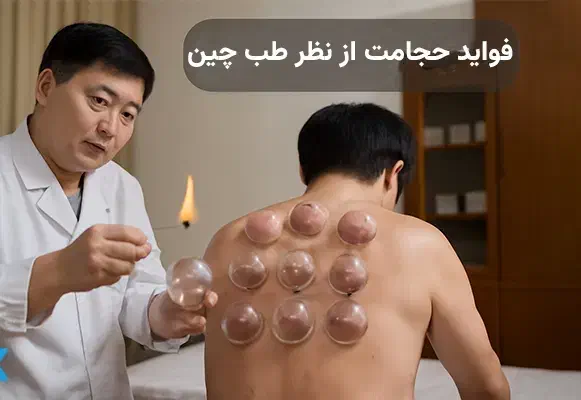 حجامت در مطب پزشک فقط ۲۵۰ تومان|خدمات آرایشگری و زیبایی|اصفهان, سودان|دیوار