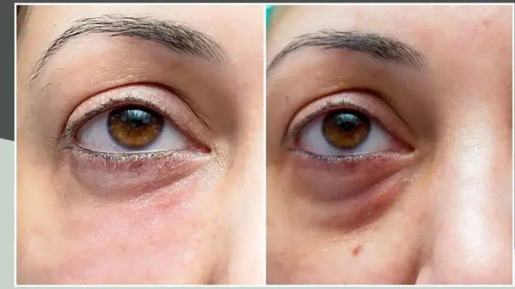 درمان ترک پا|آرایشی، بهداشتی، درمانی|شادگان, |دیوار