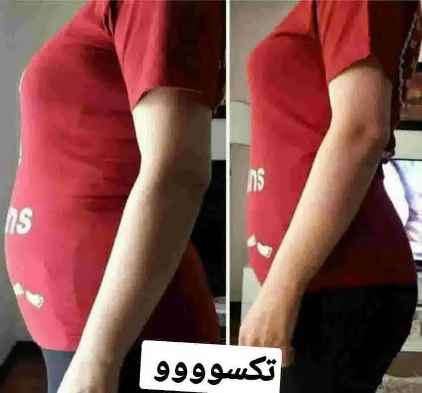پوست ومو|آرایشی، بهداشتی، درمانی|قم, قم نو|دیوار