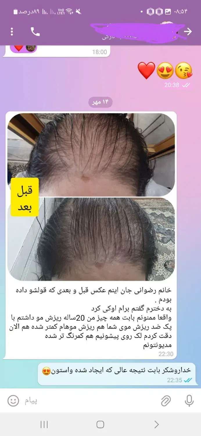 درمان  تمام مشکلات پوستی مو دهان ک دندان|آرایشی، بهداشتی، درمانی|تهران, فرمانیه|دیوار