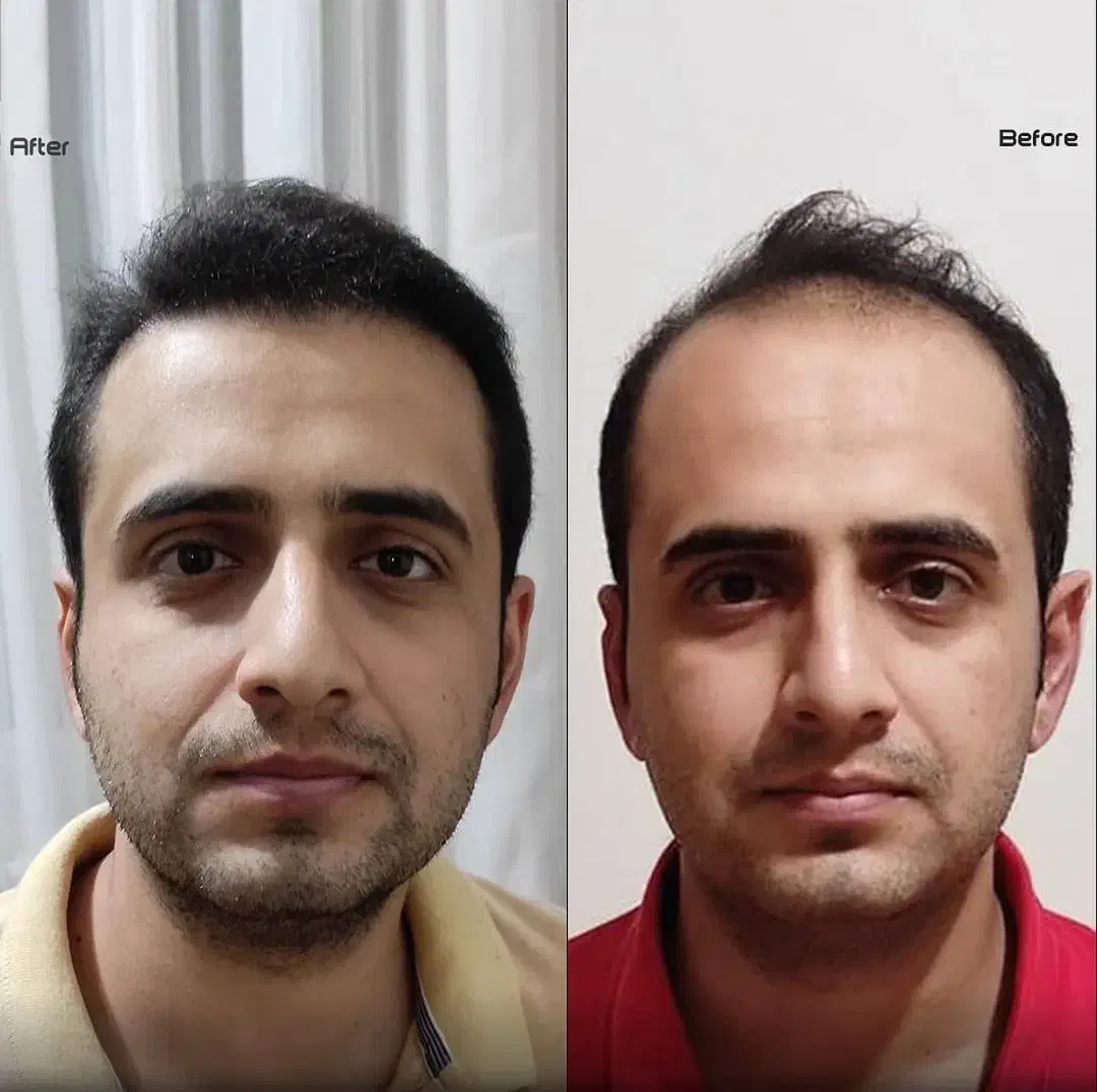 کلینیک/ جراحی بینی / ترمیم / تزریق ژل لب /|خدمات آرایشگری و زیبایی|تهران, سعادتآباد|دیوار