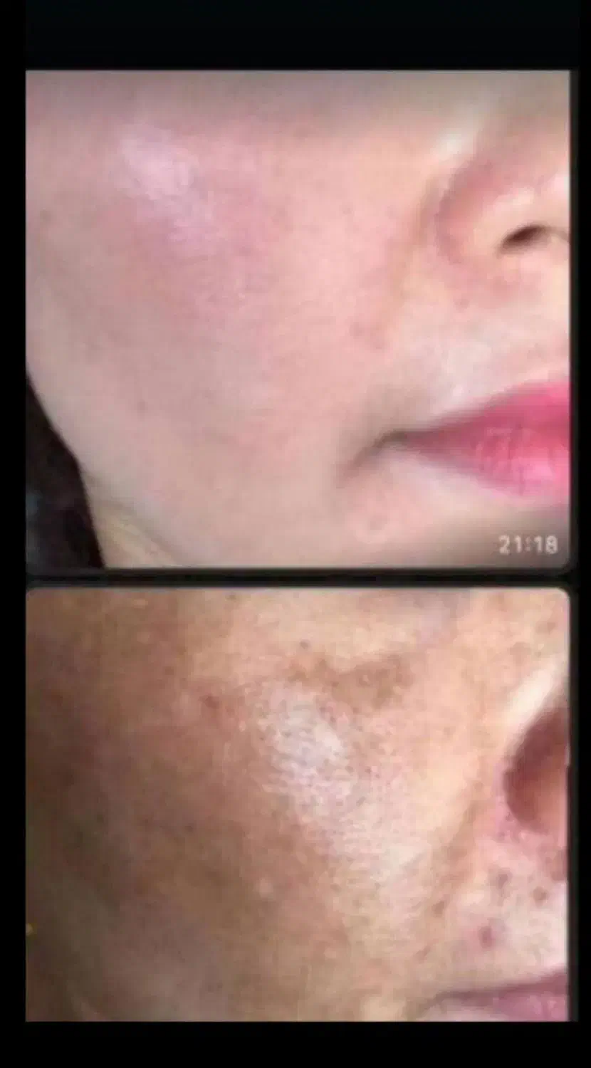 کرم سفید کننده شب (آنتی استاین )ترکیب آمپولی|آرایشی، بهداشتی، درمانی|بم, |دیوار