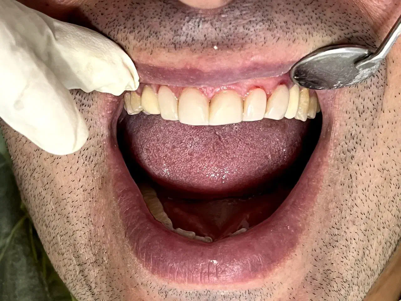 خدمات دندان پزشکی با متناسب شرایط و بودجه شما|خدمات آرایشگری و زیبایی|رودبار, |دیوار