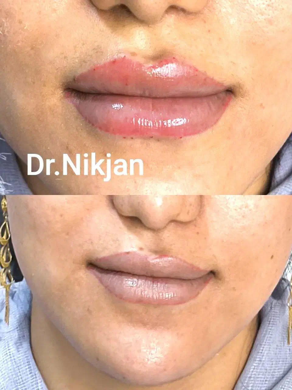 تخفیف ویژه افتتاحیه کلینیک زیبایی دکتر نیک جان|خدمات آرایشگری و زیبایی|رشت, گلسار|دیوار