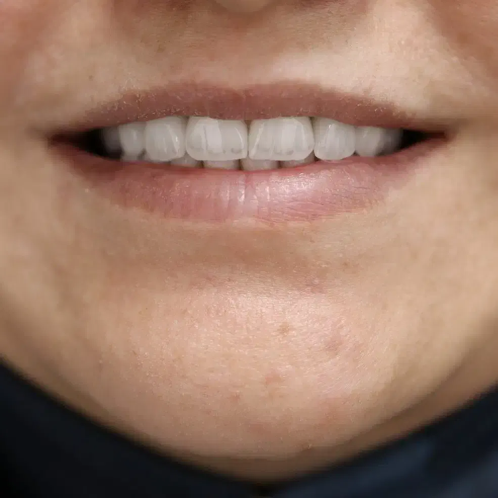 دندانپزشکی مجهز به بی حسی بدون درد دیجیتالی+اقساط|خدمات آرایشگری و زیبایی|خرم‌آباد, |دیوار