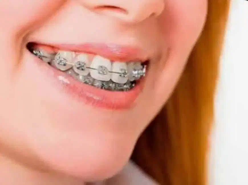 ارتودنسی|خدمات آرایشگری و زیبایی|شیراز, کیان آباد|دیوار
