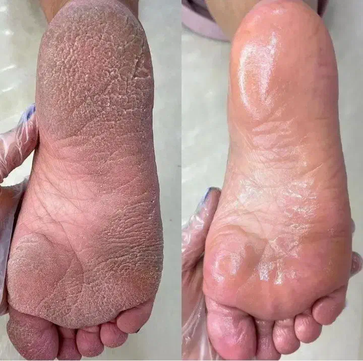 پدیکور (کفسابی)|خدمات آرایشگری و زیبایی|اسلامشهر, شهرک واوان|دیوار