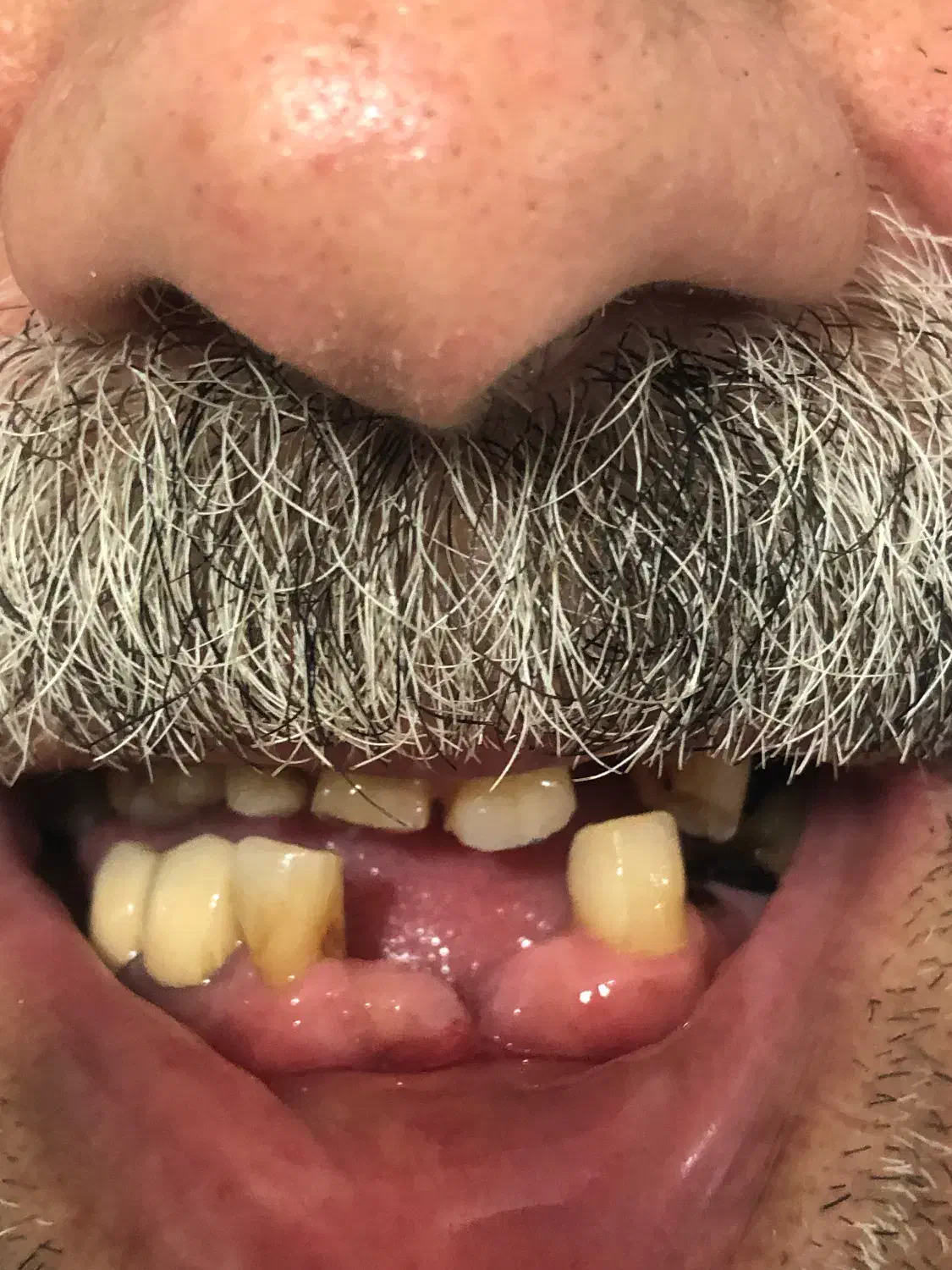 ساخت پروتز مصنوعی|پزشکی|آمل, |دیوار