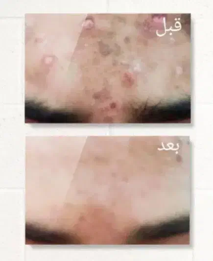 روغن های تخصصی|عمدهفروشی|زاهدان, |دیوار